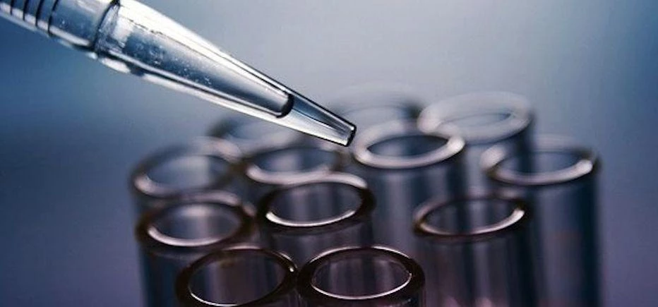 26 jobs are at risk with Immunodiagnostic Systems Holdings' latest move.