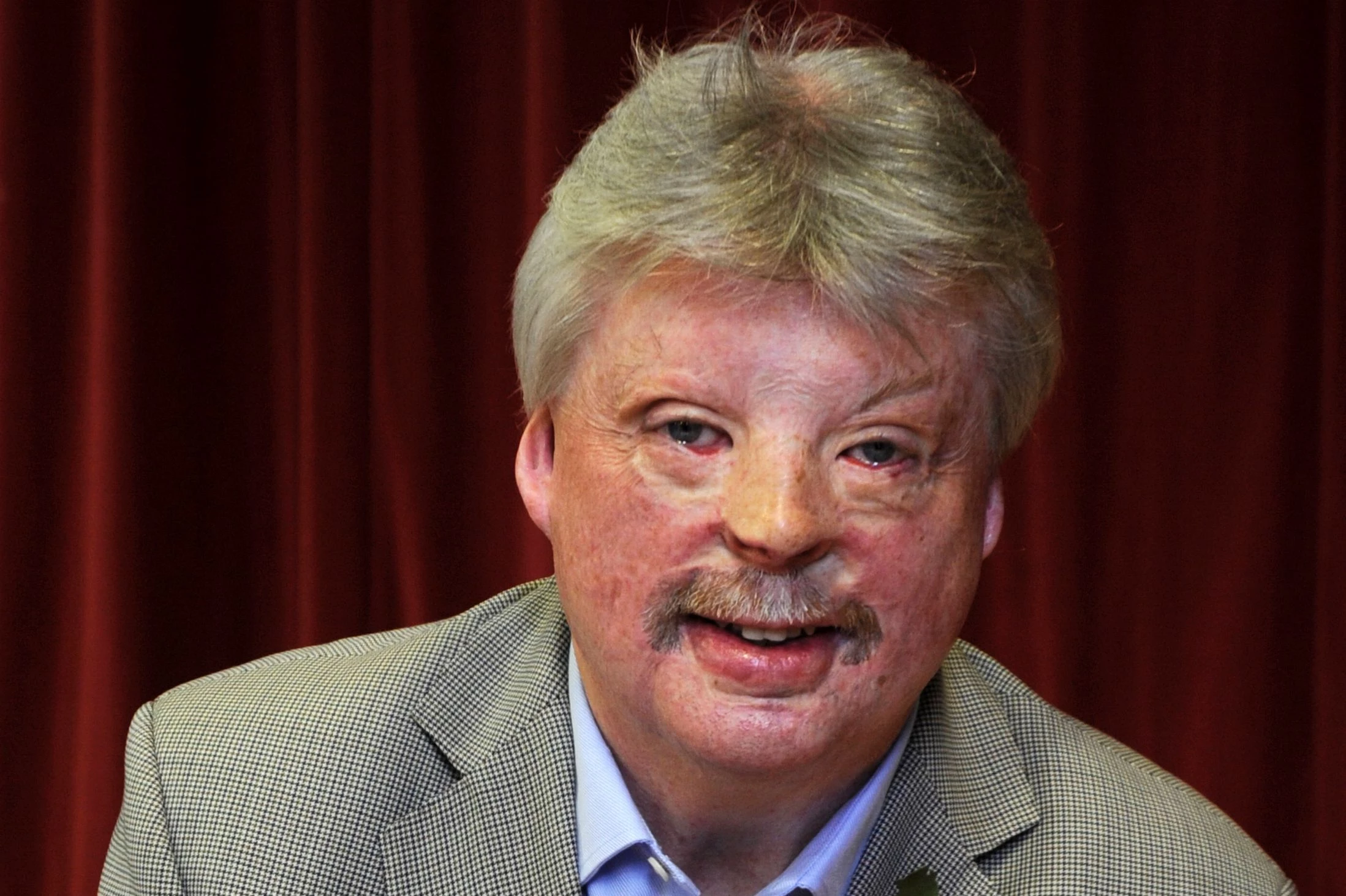 Simon Weston OBE