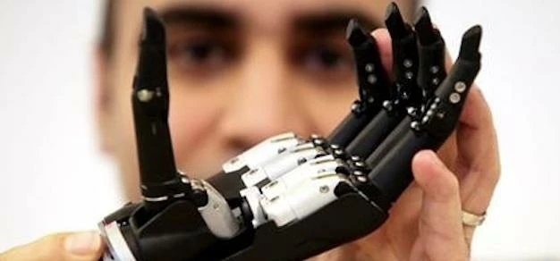 Reminiscent of Luke Skywalker’s artificial hand, the electrodes in the bionic limb would wrap around